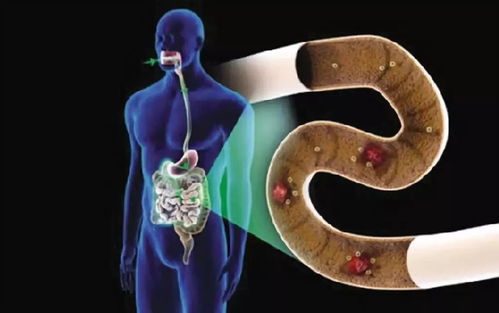 克罗恩病最常见的症状（克罗恩病一天大便几次）